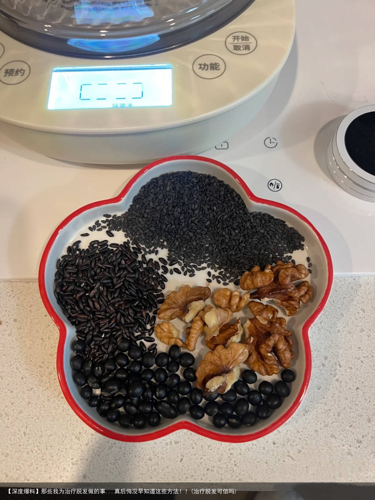 【深度爆料】那些我为治疗脱发做的事...真后悔没早知道这些方法！！(治疗脱发可信吗)