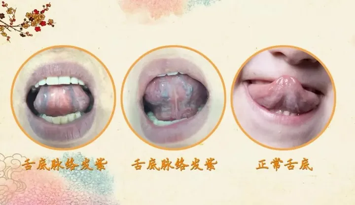 结节到底是什么？怎么消除？(身体上的结节是什么原因造成的)