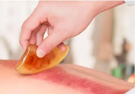 刮痧的五个简单方法 刮两肋疏肝解郁(怎么刮痧背部视频教程)