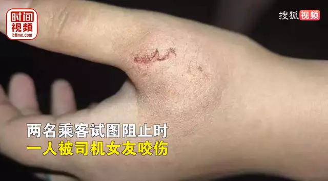 顺风车司机与女友车内打斗，乘客被咬伤!平台:赔偿50元优惠券