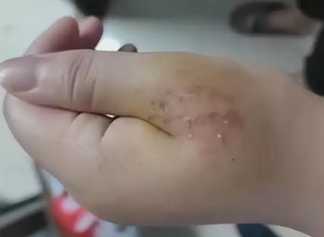 顺风车司机与女友车内打斗，乘客被咬伤!平台:赔偿50元优惠券