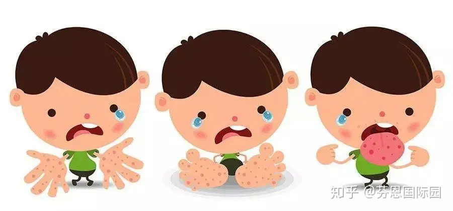 手足口、诺如病毒来了怎么办？防治办法看这里(诺如病毒会传播吗)