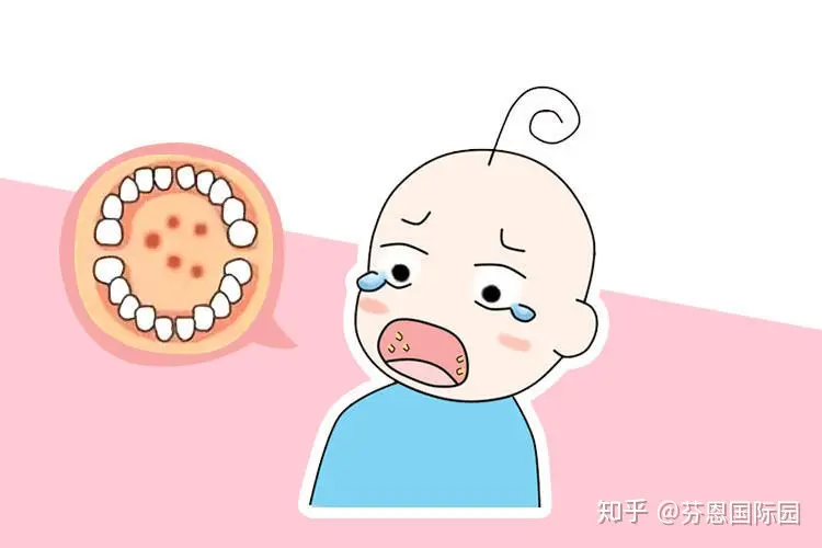手足口、诺如病毒来了怎么办？防治办法看这里(诺如病毒会传播吗)