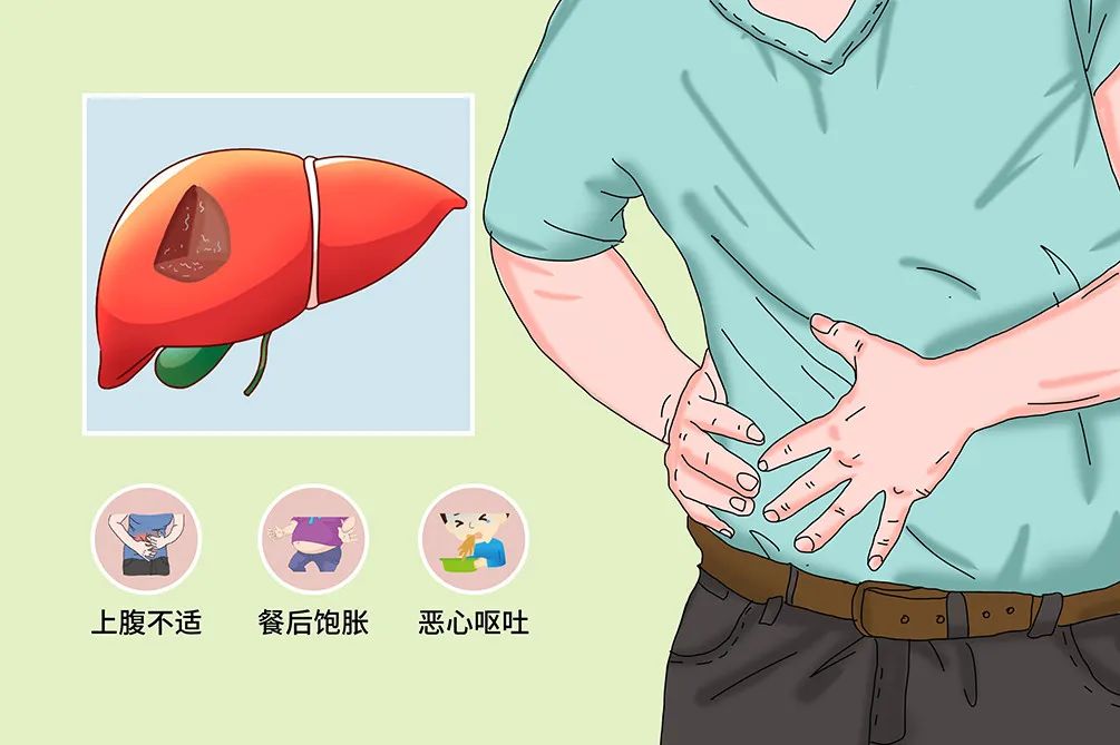 体检发现肝脏小结节，担心会癌变？有这样的表现要警惕！