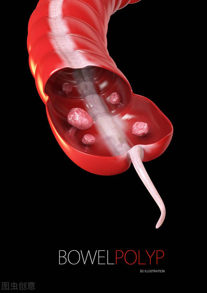 大部分的结节，根源在肝脾，李医生教你一招，疏肝健脾，软坚散结