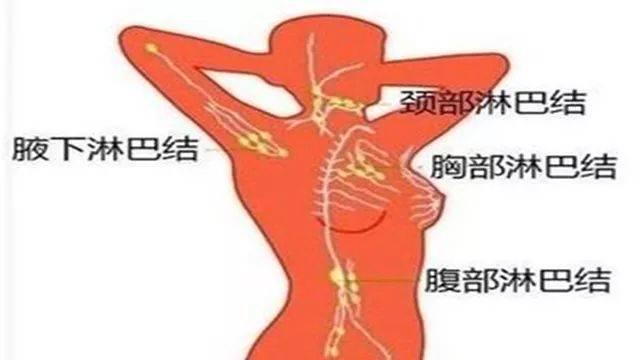 结节到底是什么？怎么消除