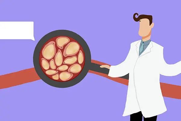 甘油三酯高的人，怎么做才能降脂？医生给出“降脂口诀”，要记住