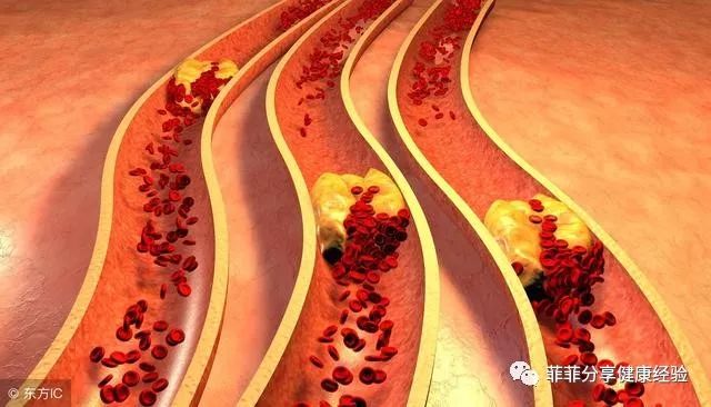 甘油三酯高，餐桌上2种食物是降脂高手，每天吃一点血脂降得快