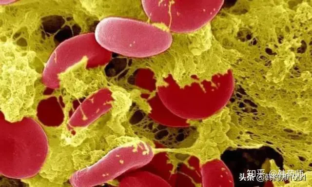 吃什么降甘油三酯最快？