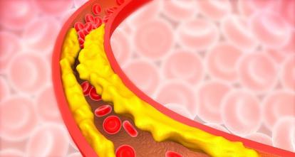 甘油三酯高的人有福了，每天吃一把这种东西，甘油三酯刷刷往下掉