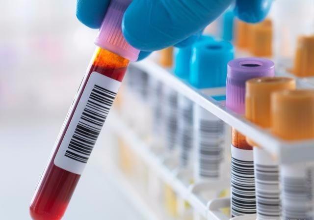 甘油三酯高了，怎么吃才能快速降下来？只知道不吃油就错了