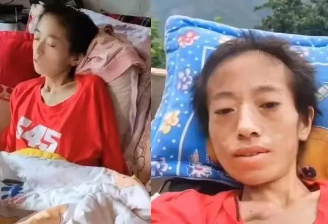 29岁抗癌母亲，是丈夫直播求打赏的工具，也是被蛆吃出洞的女人（26岁抗癌妈妈）