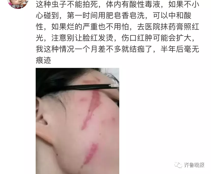 只因一条小虫，女子差点毁容！看完后怕…（一条虫打一成语是什么成语）