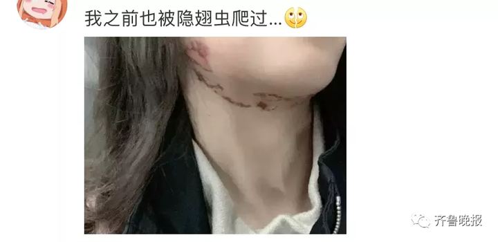 只因一条小虫，女子差点毁容！看完后怕…（一条虫打一成语是什么成语）