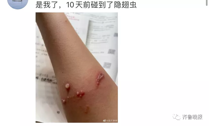 只因一条小虫，女子差点毁容！看完后怕…（一条虫打一成语是什么成语）