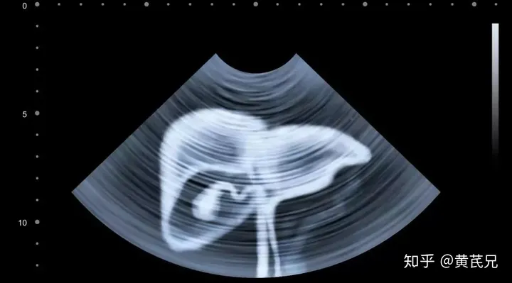 香港著名影星病逝，这个病：明星也不能幸免，全球中国人占了一半！（香港艺人病故有哪些名单）