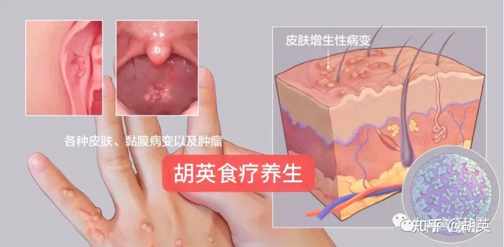 TCT报告怎么看？报告显示病变、可能是炎症！-tct检查结果怎么看报告图片