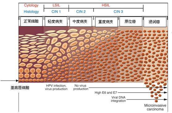 宫颈病变是什么病？是癌吗？-宫颈病变的主要症状