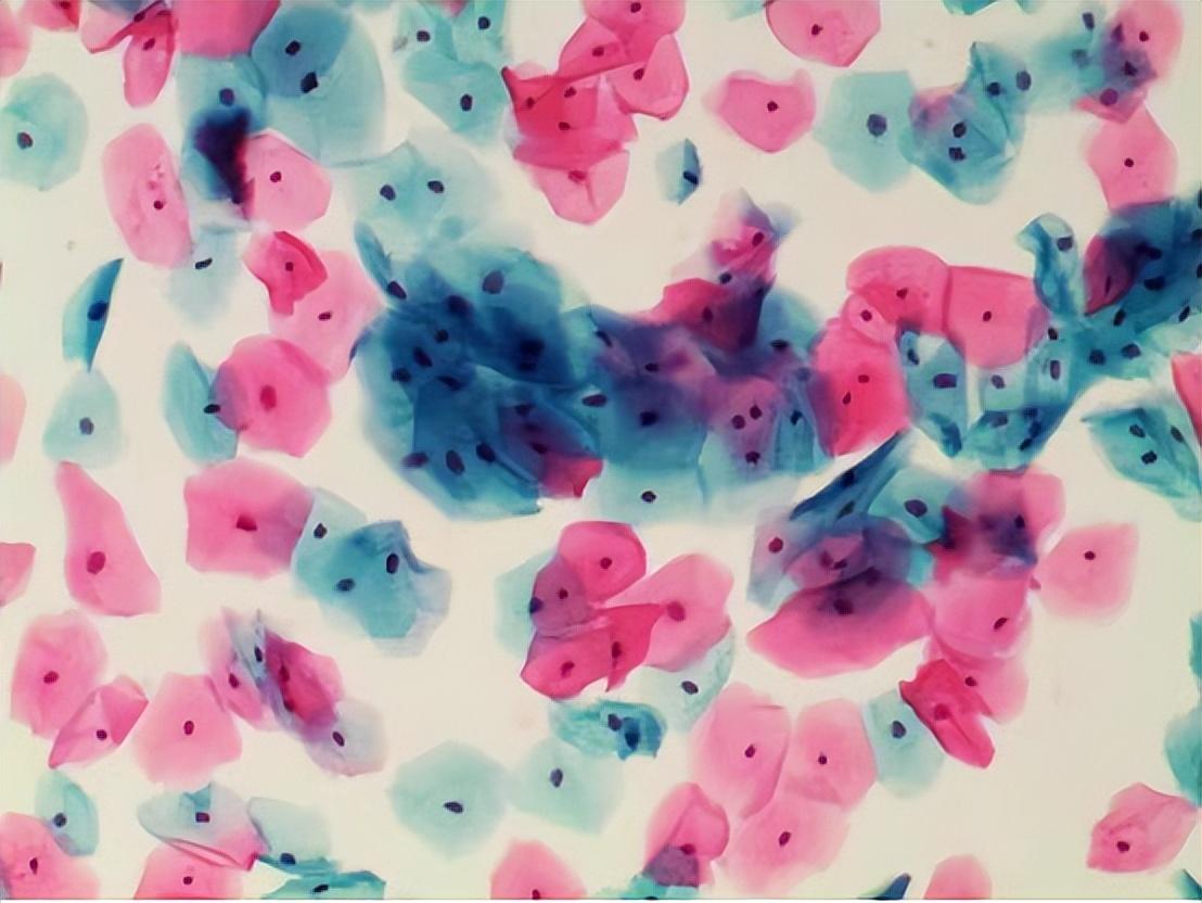 科普 | 妇科检查的TCT和HPV有什么区别？-妇科tct与hpv 检查有什么区别