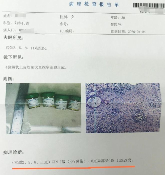 如果查出HPV阳性须警惕！-检查出来hpv阳性可以打四价吗