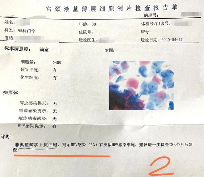 如果查出HPV阳性须警惕！-检查出来hpv阳性可以打四价吗