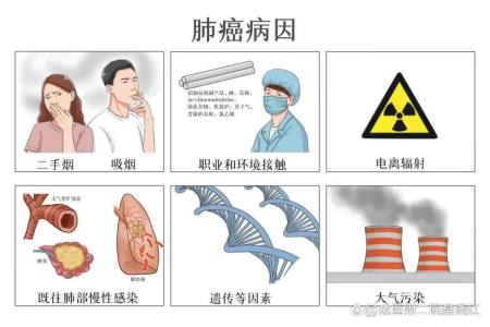 确诊肺癌，需要做哪些检查？-肺癌确诊都需要做什么检查