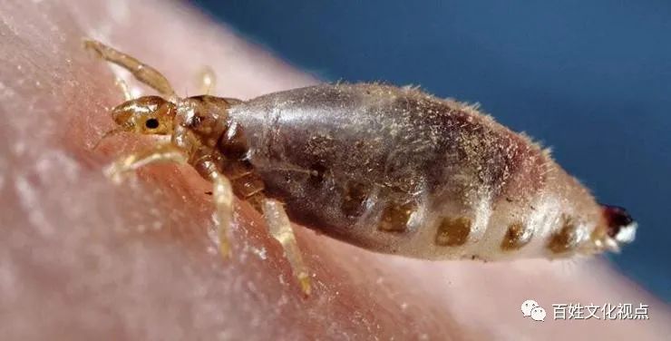 1980年代那些臭虫、虱子、跳蚤们-80后小时候的