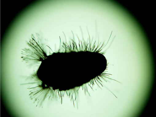 万物复苏，孩子身上起皮疹，你一定要看看这篇！-孩子身上皮疹怎么回事