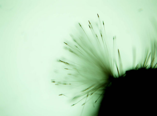 万物复苏，孩子身上起皮疹，你一定要看看这篇！-孩子身上皮疹怎么回事