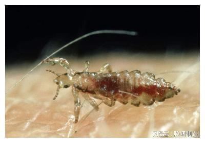 为何小时候大多数人都会长的“虱子”，现在都不见了？今天知道了-为什么小时候头上长虱子长大了不长