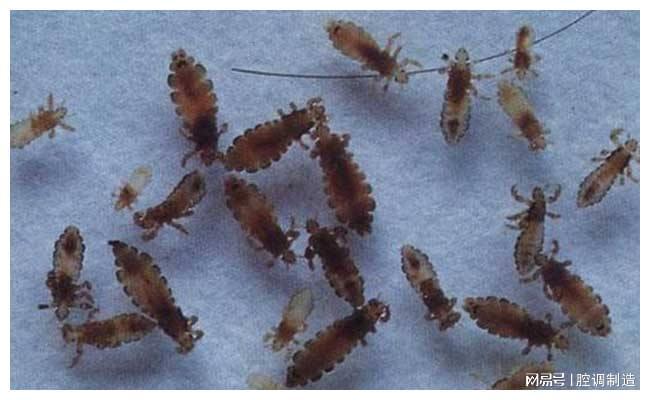 为何小时候大多数人都会长的“虱子”，现在都不见了？今天知道了-为什么小时候头上长虱子长大了不长