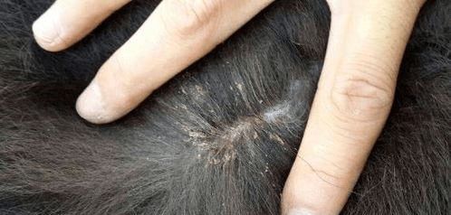 虱子是咋来的？30年前男女老少都长虱子，为何现在却“销声匿迹”-虱子的由来这是怎么长出来的