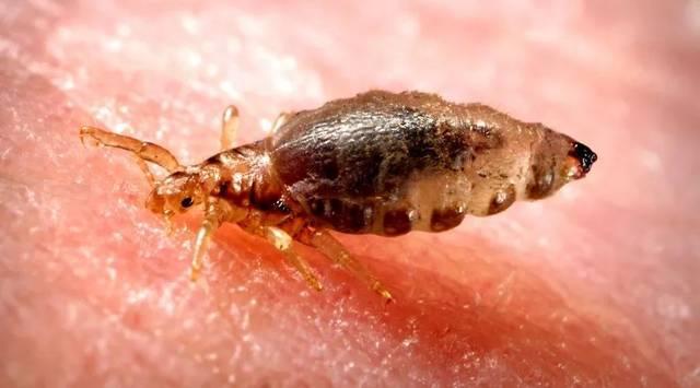 虱子是咋来的？30年前男女老少都长虱子，为何现在却“销声匿迹”-虱子的由来这是怎么长出来的
