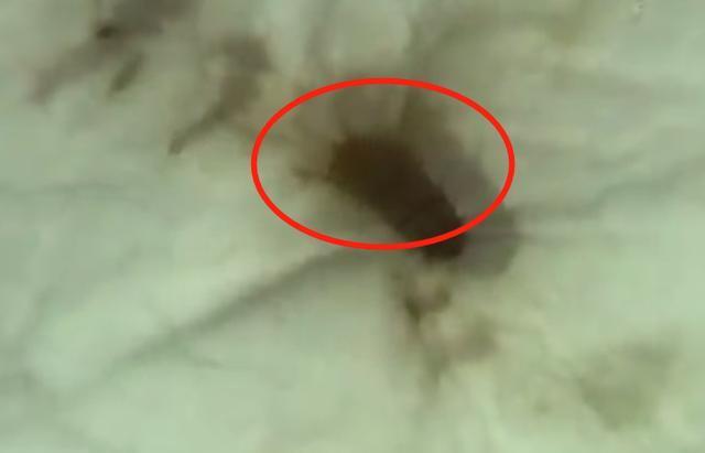 只要躺下就有东西蠕动，打开床垫一看女子崩溃：浑身都起鸡皮疙瘩-躺下不动感觉有小虫在爬一样的感觉