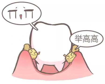 一篇关于洗牙的科普小文，看你知道多少洗牙的知识-洗牙的基本要点