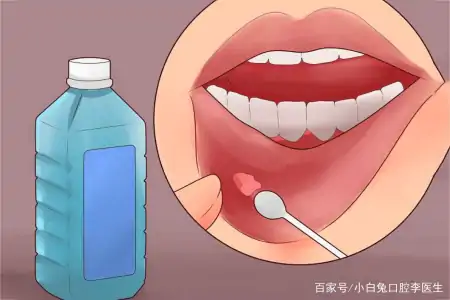 一篇关于洗牙的科普小文，看你知道多少洗牙的知识-洗牙的基本要点