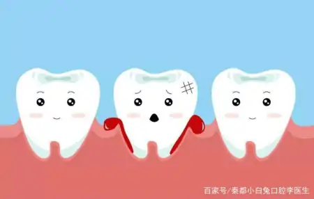 一篇关于洗牙的科普小文，看你知道多少洗牙的知识-洗牙的基本要点