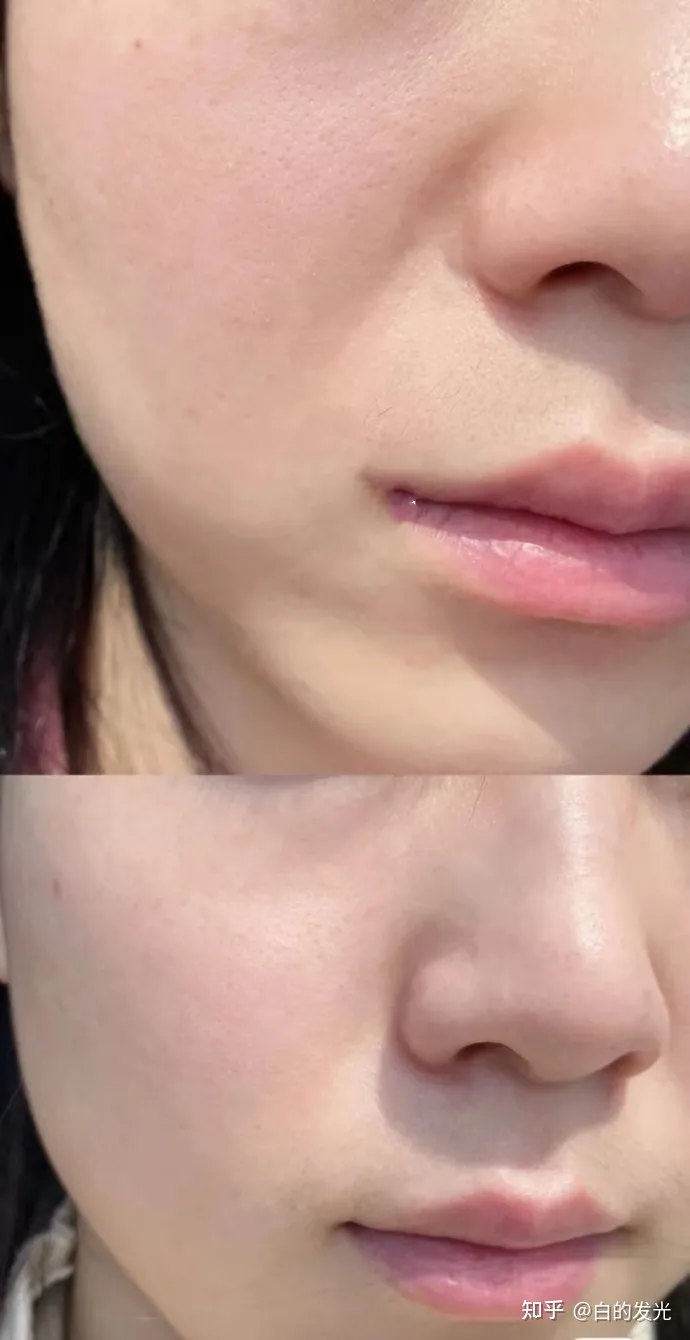 提拉紧致抗皱的护肤品哪个好？-提拉紧致抗皱的护肤品哪个好30岁