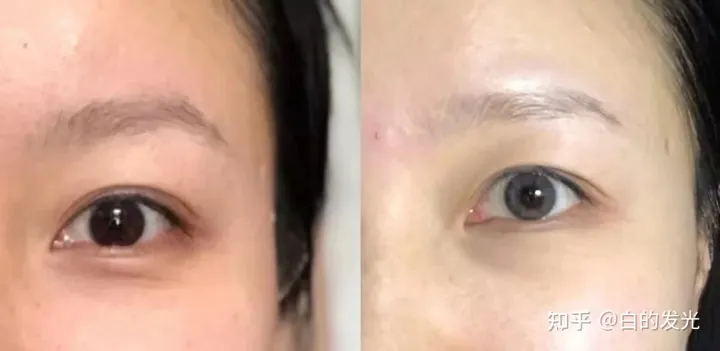 提拉紧致抗皱的护肤品哪个好？-提拉紧致抗皱的护肤品哪个好30岁