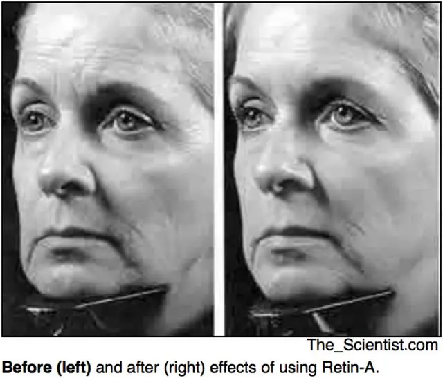 有哪些紧致效果的护肤品？-紧致皮肤的护肤品真的有用吗