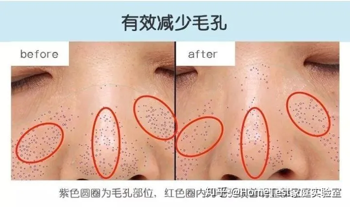 有哪些紧致效果的护肤品？-紧致皮肤的护肤品真的有用吗