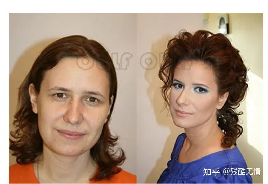 深度科普：筋膜悬吊提升术是什么、筋膜提拉一般多少钱~-筋膜悬吊是拉皮吗