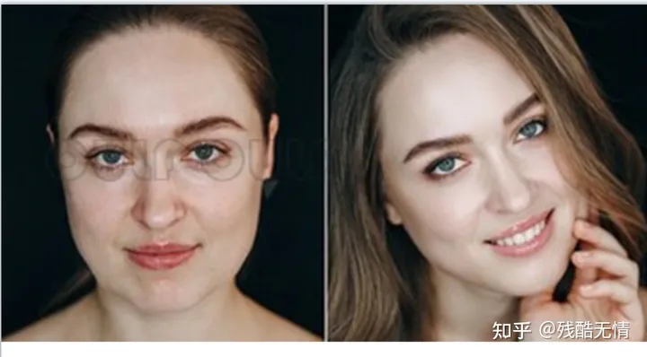 深度科普：筋膜悬吊提升术是什么、筋膜提拉一般多少钱~-筋膜悬吊是拉皮吗