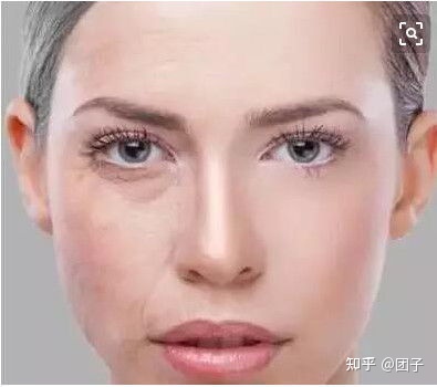 调查：筋膜悬吊面部提升术保持多久？筋膜提拉一般多少钱-筋膜悬吊术是拉皮吗