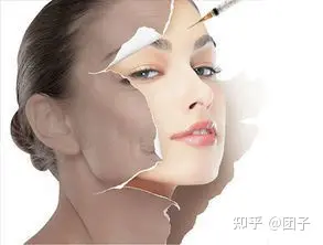 筋膜悬吊面部提升术后悔死了？筋膜悬吊面部提升术原理-无痕筋膜提升术多少钱