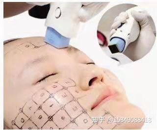 7d聚拉提做一次多少钱价格，7d聚拉提做一次维持多久~-7d聚拉提做一次维持多长时间