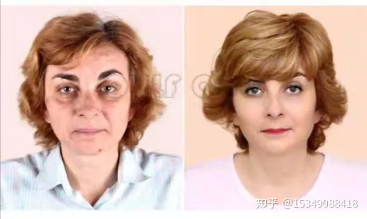 7d聚拉提做一次多少钱价格，7d聚拉提做一次维持多久~-7d聚拉提做一次维持多长时间