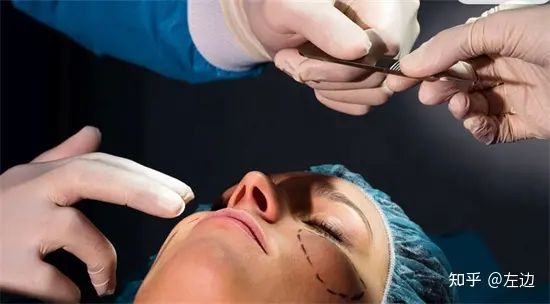 筋膜提升术是什么、筋膜提升拉皮手术维持多久-筋膜提拉手法