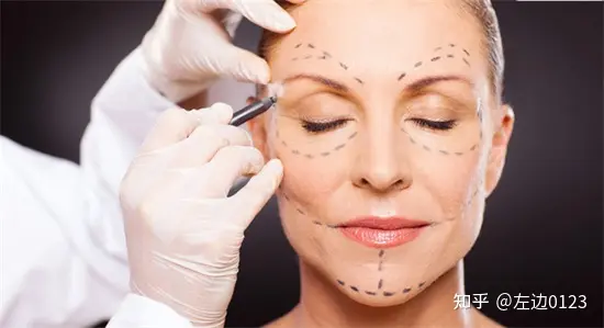 筋膜悬吊术、筋膜悬吊提升术是什么-筋膜悬吊术,筋膜悬吊提升术是什么手术