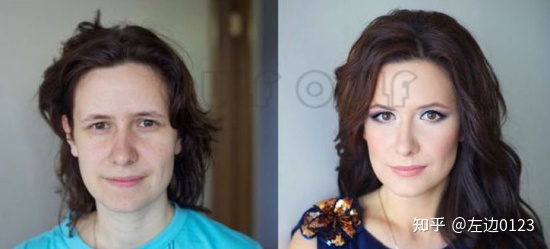 筋膜悬吊术、筋膜悬吊提升术是什么-筋膜悬吊术,筋膜悬吊提升术是什么手术